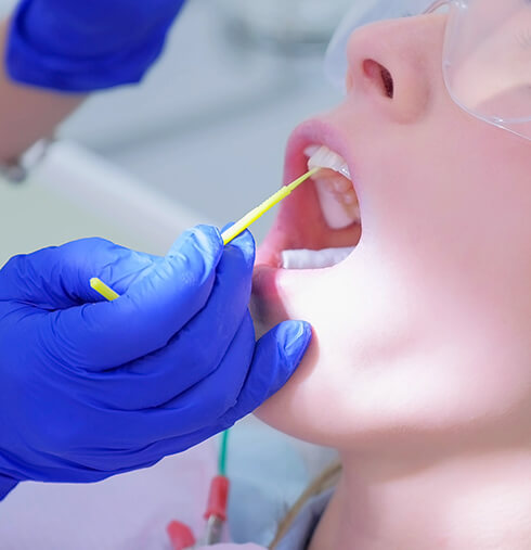 dentist applying fluoride to a patient's teeth